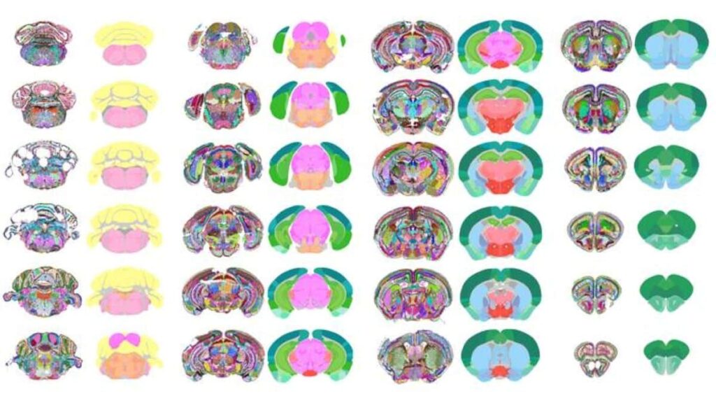 AI Builds the Most Detailed Map of the Mouse Brain Yet